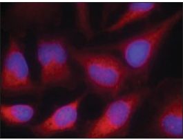 Anti-VASP (Ab-157) antibody produced in rabbitaffinity isolated antibody