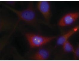 Anti-CTNNB1 (Ab-33) antibody produced in rabbitaffinity isolated antibody