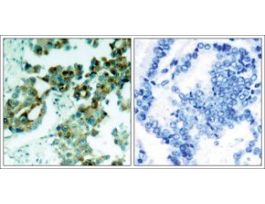 Anti-RPS6 (Ab-235) antibody produced in rabbitaffinity isolated antibody