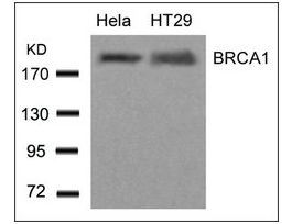 Anti-BRCA1 (Ab-1423) antibody produced in rabbitaffinity isolated antibody