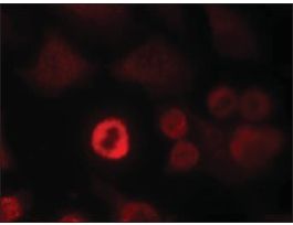 Anti-Snca (Ab-136) antibody produced in rabbitaffinity isolated antibody
