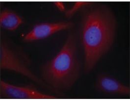 Anti-NFKB1 (Ab-927) antibody produced in rabbitaffinity isolated antibody
