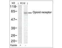 Anti-OPRM1 (Ab-375) antibody produced in rabbitaffinity isolated antibody