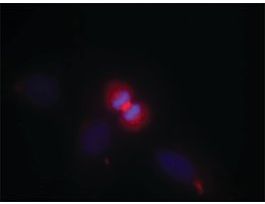 Anti-AKT1 (Ab-450) antibody produced in rabbitaffinity isolated antibody