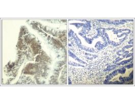 Anti-CDK6 (Ab-13) antibody produced in rabbitaffinity isolated antibody