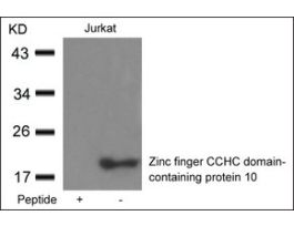 Anti-ZCCHC10 antibody produced in rabbitaffinity isolated antibody