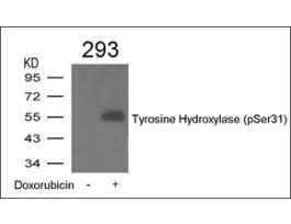Anti-phospho-Tyrosine Hydroxylase (pSer31) antibody produced in rabbitaffinity isolated antibody
