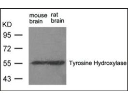 Anti-Th (Ab-31) antibody produced in rabbitaffinity isolated antibody