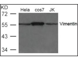 Anti-Vimentin antibody produced in rabbitaffinity isolated antibody