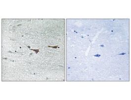 Anti-TOB1 antibody produced in rabbit~1 mg/mL, affinity isolated antibody, buffered aqueous solution