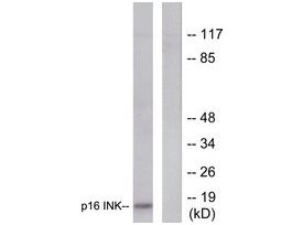 Anti-p16 INK, N-Terminal antibody produced in rabbit~1 mg/mL, affinity isolated antibody, buffered aqueous solution