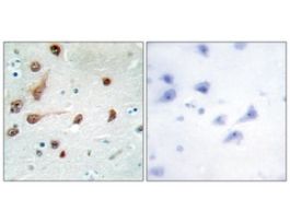 Anti-ADAR1, C-Terminal antibody produced in rabbit~1 mg/mL, affinity isolated antibody, buffered aqueous solution