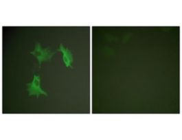 Anti-Tubulin alpha, C-Terminal antibody produced in rabbit~1 mg/mL, affinity isolated antibody, buffered aqueous solution