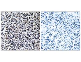 Anti-TACC3, C-Terminal antibody produced in rabbit~1 mg/mL, affinity isolated antibody, buffered aqueous solution
