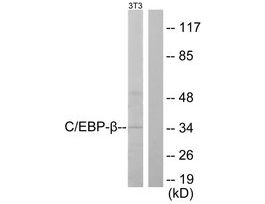 Anti-C/EBP-beta antibody produced in rabbit~1 mg/mL, affinity isolated antibody, buffered aqueous solution