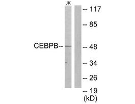 Anti-CEBPB, C-Terminal antibody produced in rabbit~1 mg/mL, affinity isolated antibody, buffered aqueous solution