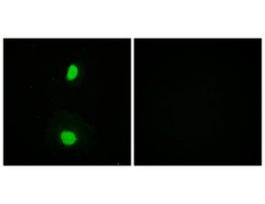 Anti-TIP60 antibody produced in rabbit~1 mg/mL, affinity isolated antibody, buffered aqueous solution