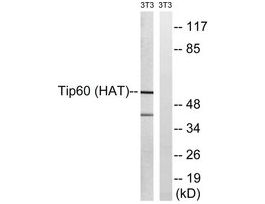 Anti-TIP60 antibody produced in rabbit~1 mg/mL, affinity isolated antibody, buffered aqueous solution