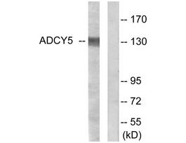 Anti-ADCY5, C-Terminal antibody produced in rabbit~1 mg/mL, affinity isolated antibody, buffered aqueous solution