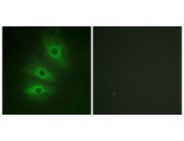 Anti-ADCY5, C-Terminal antibody produced in rabbit~1 mg/mL, affinity isolated antibody, buffered aqueous solution