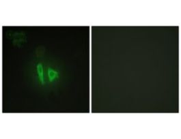 Anti-AKAP11, C-Terminal antibody produced in rabbit~1 mg/mL, affinity isolated antibody, buffered aqueous solution