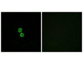 Anti-CKLF1, C-Terminal antibody produced in rabbit~1 mg/mL, affinity isolated antibody, buffered aqueous solution
