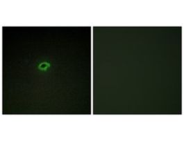Anti-Collagen IV alpha4 antibody produced in rabbit~1 mg/mL, affinity isolated antibody, buffered aqueous solution