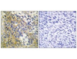 Anti-Collagen IV alpha6 antibody produced in rabbit~1 mg/mL, affinity isolated antibody, buffered aqueous solution