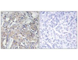 Anti-Collagen VI alpha3 antibody produced in rabbit~1 mg/mL, affinity isolated antibody, buffered aqueous solution