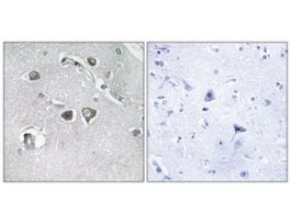 Anti-Collagen XI alpha2 antibody produced in rabbit~1 mg/mL, affinity isolated antibody, buffered aqueous solution