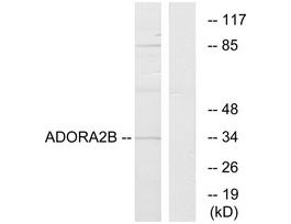 Anti-ADORA2B, C-Terminal antibody produced in rabbit~1 mg/mL, affinity isolated antibody, buffered aqueous solution