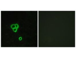 Anti-GPR119 antibody produced in rabbit~1 mg/mL, affinity isolated antibody, buffered aqueous solution