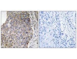 Anti-NEK7 antibody produced in rabbit~1 mg/mL, affinity isolated antibody, buffered aqueous solution