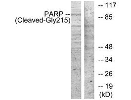 Anti-PARP (Cleaved-Gly215) antibody produced in rabbit~1 mg/mL, affinity isolated antibody, buffered aqueous solution