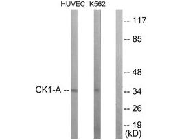 Anti-CKI-alpha, C-Terminal antibody produced in rabbit~1 mg/mL, affinity isolated antibody, buffered aqueous solution