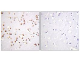Anti-Catenin-delta1 antibody produced in rabbit~1 mg/mL, affinity isolated antibody, buffered aqueous solution