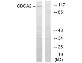 Anti-CDCA2 antibody produced in rabbit~1 mg/mL, affinity isolated antibody, buffered aqueous solution