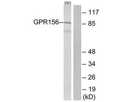 Anti-GPR156 antibody produced in rabbit~1 mg/mL, affinity isolated antibody, buffered aqueous solution