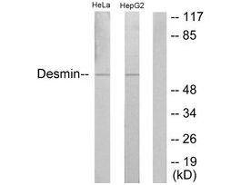 Anti-Desmin, N-Terminal antibody produced in rabbit~1 mg/mL, affinity isolated antibody, buffered aqueous solution