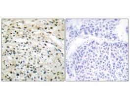 Anti-DNMT3B, N-Terminal antibody produced in rabbit~1 mg/mL, affinity isolated antibody, buffered aqueous solution