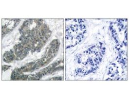 Anti-P62 DOK, C-Terminal antibody produced in rabbit~1 mg/mL, affinity isolated antibody, buffered aqueous solution