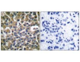 Anti-EEF2, N-Terminal antibody produced in rabbit~1 mg/mL, affinity isolated antibody, buffered aqueous solution