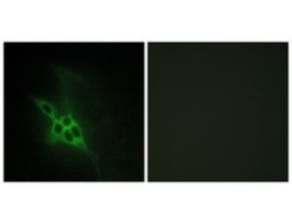 Anti-EPHB1 antibody produced in rabbit~1 mg/mL, affinity isolated antibody, buffered aqueous solution