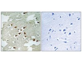 Anti-AKT, C-Terminal antibody produced in rabbit~1 mg/mL, affinity isolated antibody, buffered aqueous solution