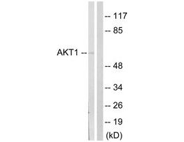 Anti-AKT antibody produced in rabbit~1 mg/mL, affinity isolated antibody, buffered aqueous solution