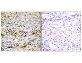 Anti-AKT, C-Terminal antibody produced in rabbit~1 mg/mL, affinity isolated antibody, buffered aqueous solution