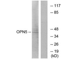 Anti-OPN5, C-Terminal antibody produced in rabbit~1 mg/mL, affinity isolated antibody, buffered aqueous solution