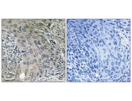 Anti-COPZ1, N-Terminal antibody produced in rabbit~1 mg/mL, affinity isolated antibody, buffered aqueous solution