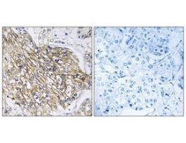 Anti-LPHN2 antibody produced in rabbit~1 mg/mL, affinity isolated antibody, buffered aqueous solution