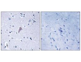 Anti-MTOR, C-Terminal antibody produced in rabbit~1 mg/mL, affinity isolated antibody, buffered aqueous solution